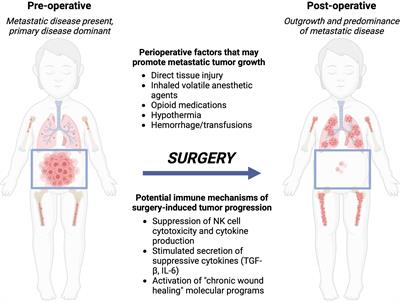 Targeted immune activation in pediatric solid tumors: opportunities to complement local control approaches